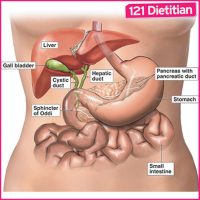 gallstones diet